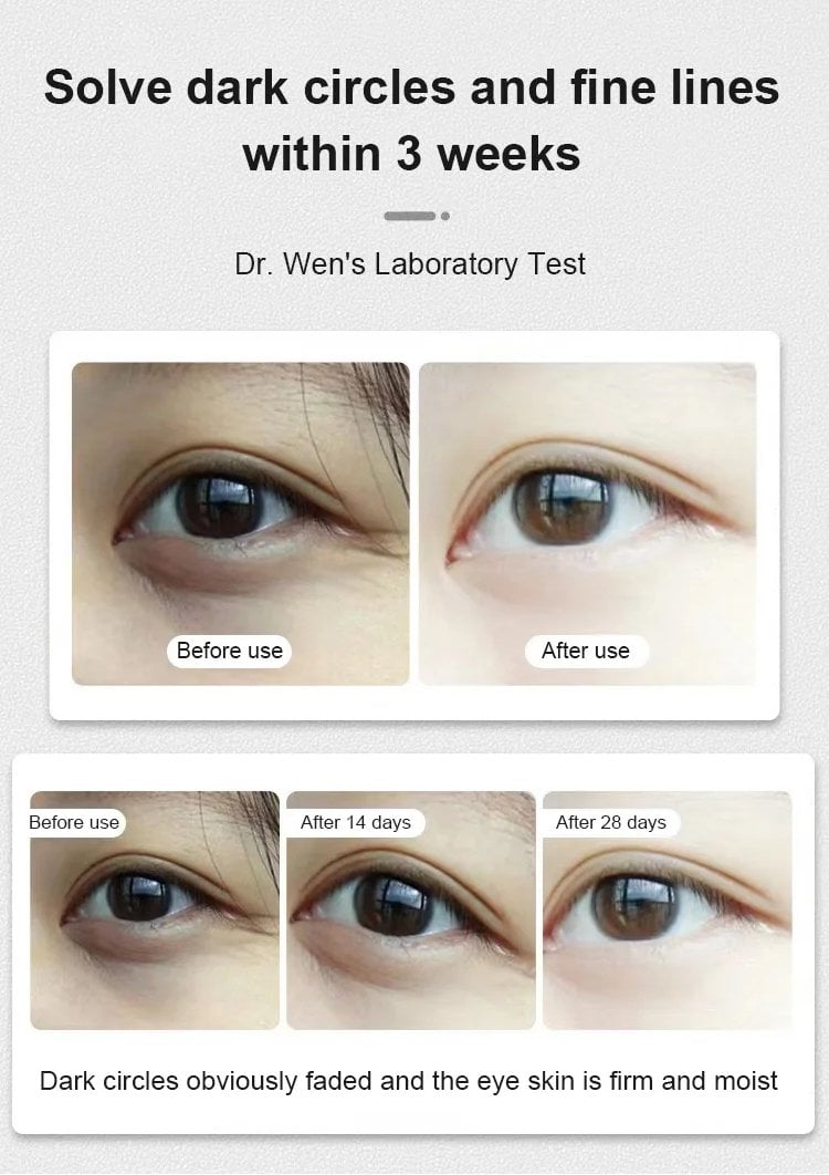 12-20-杨新育-1057051Dinkiss叶黄素眼部精华油_11.jpg 12-20-杨新育-1057051Dinkiss叶黄素眼部精华油_11.jpg