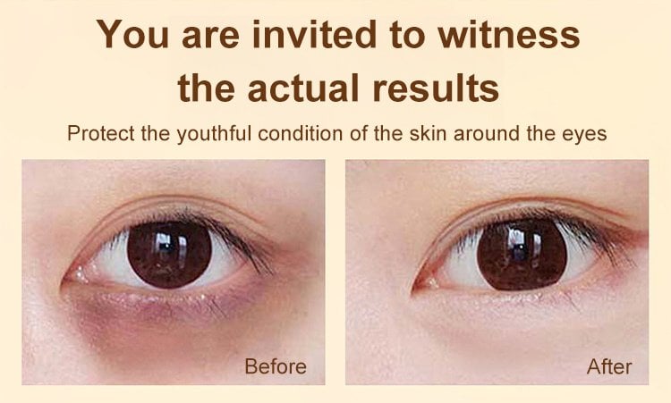 12-20-杨新育-1057051Dinkiss叶黄素眼部精华油_25.jpg 12-20-杨新育-1057051Dinkiss叶黄素眼部精华油_25.jpg